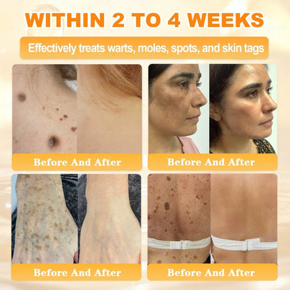 【𝟐𝟎𝟐𝟔 𝐍𝐞𝐰 𝐔𝐩𝐠𝐫𝐚𝐝𝐞: 𝟖𝟎% 𝐎𝐅𝐅】📎🍯Aeehfeng® Bee Venom Skin Restoration Cream – with Royal Jelly, Hyaluronic Acid and Bee Venom for skin hydration, elasticity, anti-aging & repair