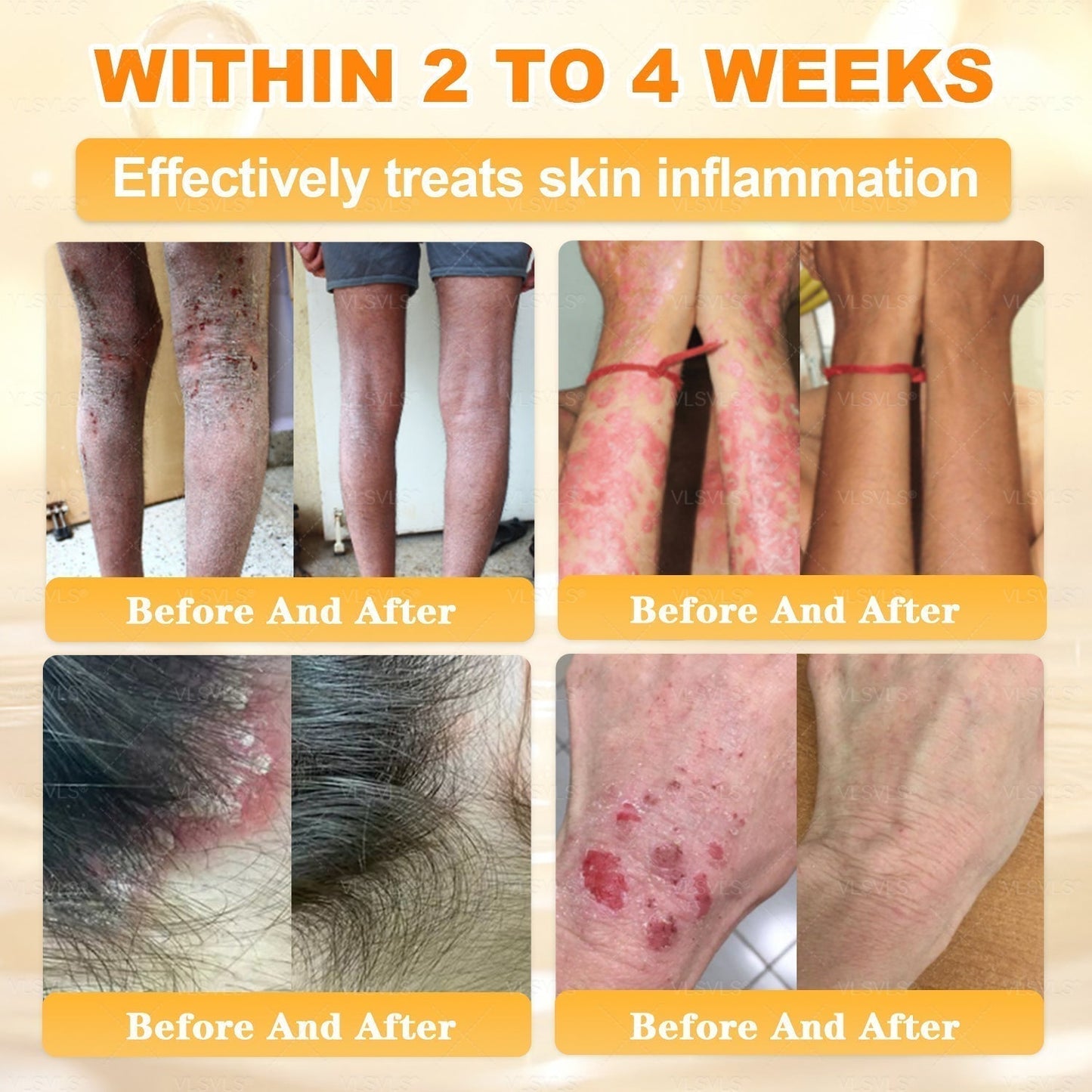 【𝟐𝟎𝟐𝟔 𝐍𝐞𝐰 𝐔𝐩𝐠𝐫𝐚𝐝𝐞: 𝟖𝟎% 𝐎𝐅𝐅】📎🍯Aeehfeng® Bee Venom Skin Restoration Cream – with Royal Jelly, Hyaluronic Acid and Bee Venom for skin hydration, elasticity, anti-aging & repair